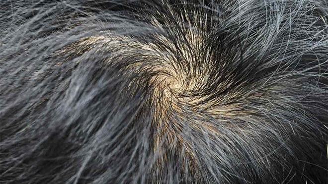scalp showing hair loss